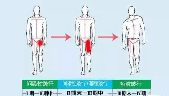 腰垫的演变，从汽车品牌到健康生活的关键元素